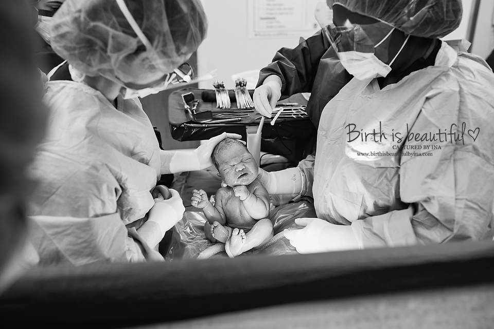 Rex c-section,Baylor University Medical Center at Dallas , hospital birth photography