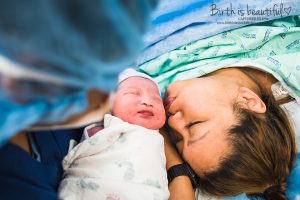 Rex c-section,Baylor University Medical Center at Dallas , hospital birth photography