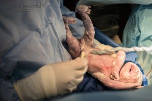 Tripp, Baylor Medical center at McKinney, Hospital Birth Photography